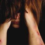 همه چیز درباره خودزنی در نوجوانان